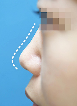 医師による見立て