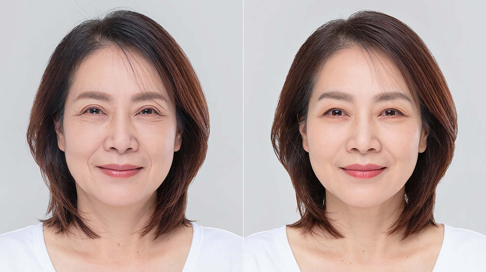 【30年後・40年後】鼻整形から30〜40年後の長期的な影響