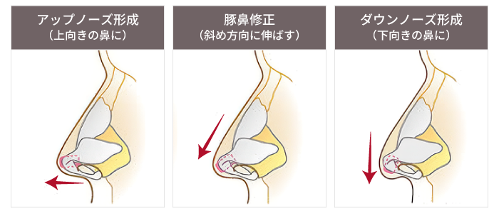 「上向きにする」「下向きにする」の技術的な違いについて