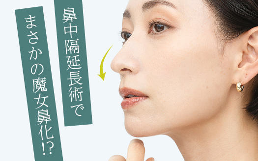 鼻中隔延長後に魔女鼻化！？失敗リスクの解説